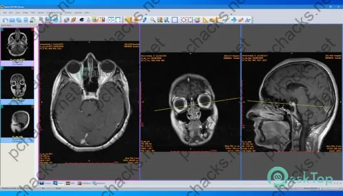 Sante DICOM Viewer Pro Crack 14.0.6 Full Free Activated