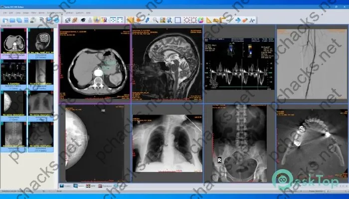 Sante DICOM Editor Crack 10.0.2 Free Download